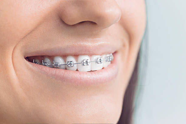 Best Traditional Braces  in Savage, MN